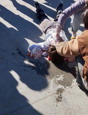 Следователи проводят проверку после травмирования ребенка в скейт-парке в Кирове